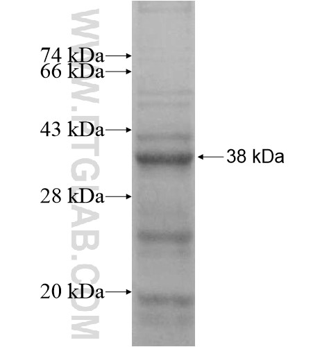 FRMD5 fusion protein Ag15138 SDS-PAGE FRMD5 fusion protein Ag15138 SDS-PAGE