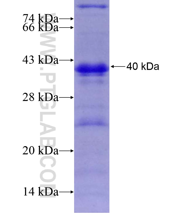 Willin fusion protein Ag17038 SDS-PAGE