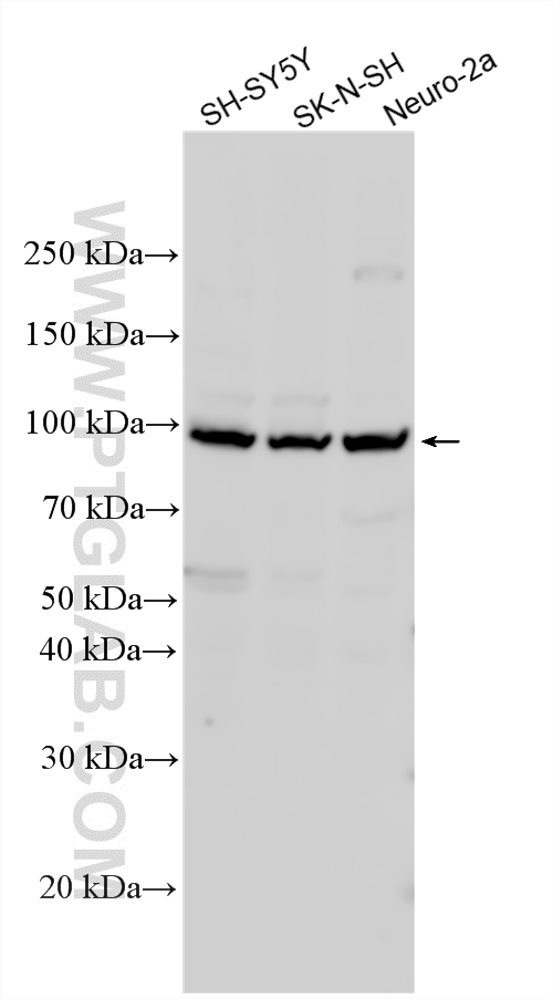 WB analysis using 25033-1-AP