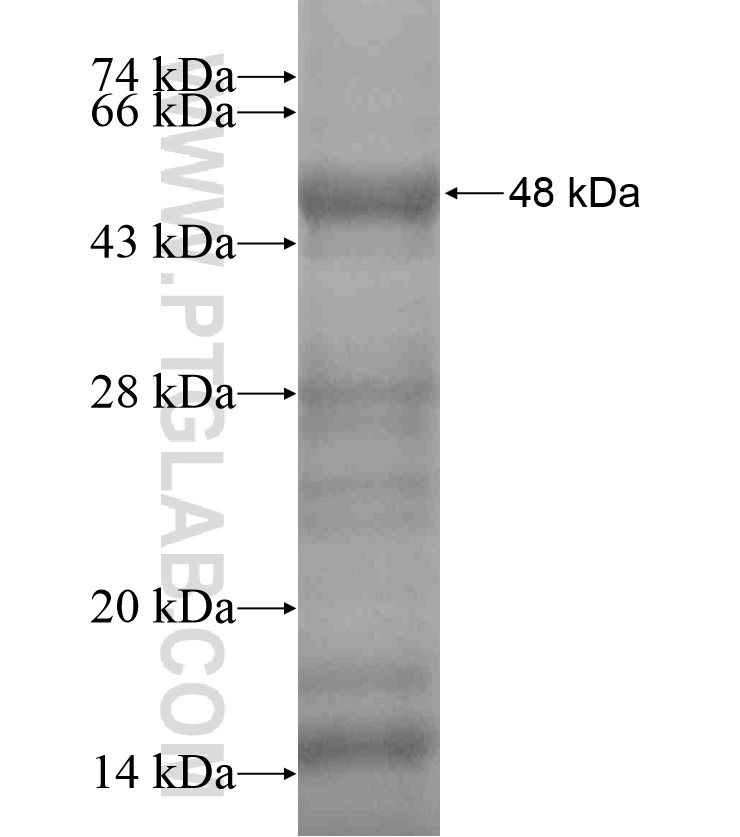 FRMD7 fusion protein Ag18161 SDS-PAGE FRMD7 fusion protein Ag18161 SDS-PAGE