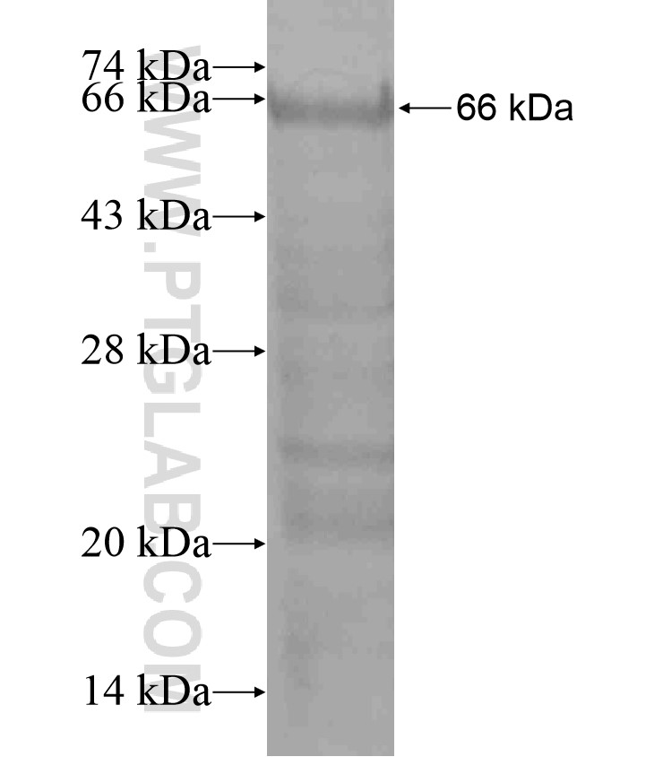FRMPD1 fusion protein Ag18139 SDS-PAGE FRMPD1 fusion protein Ag18139 SDS-PAGE