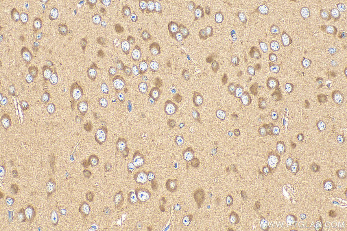 IHC staining of mouse brain using 31635-1-AP