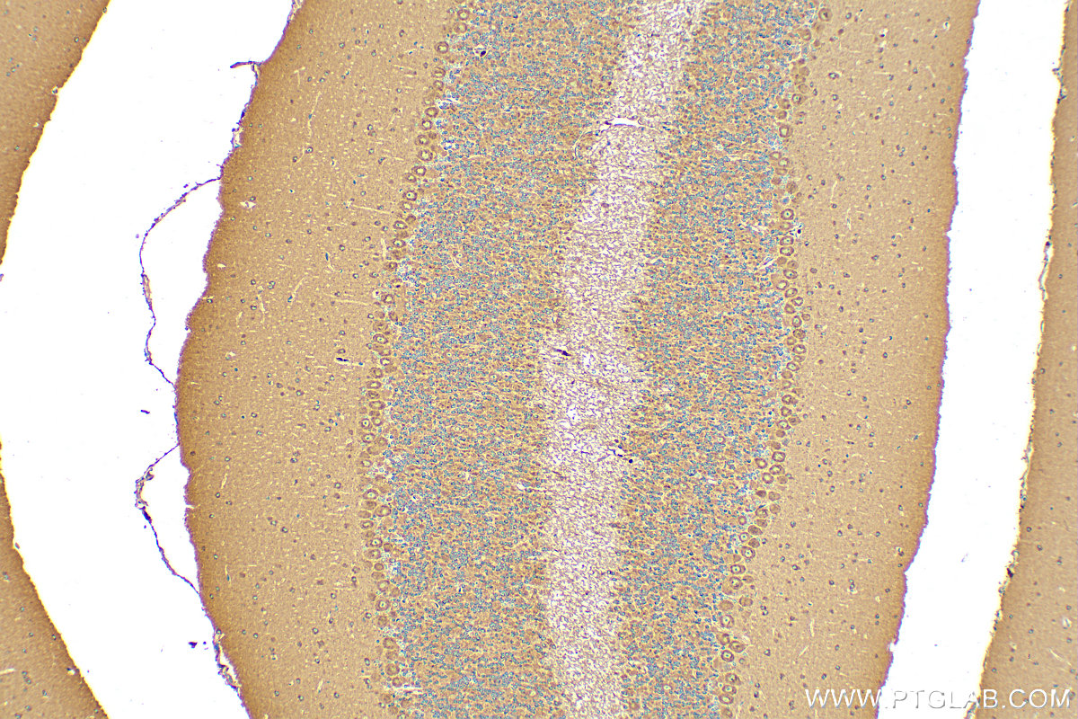IHC staining of mouse cerebellum using 31635-1-AP