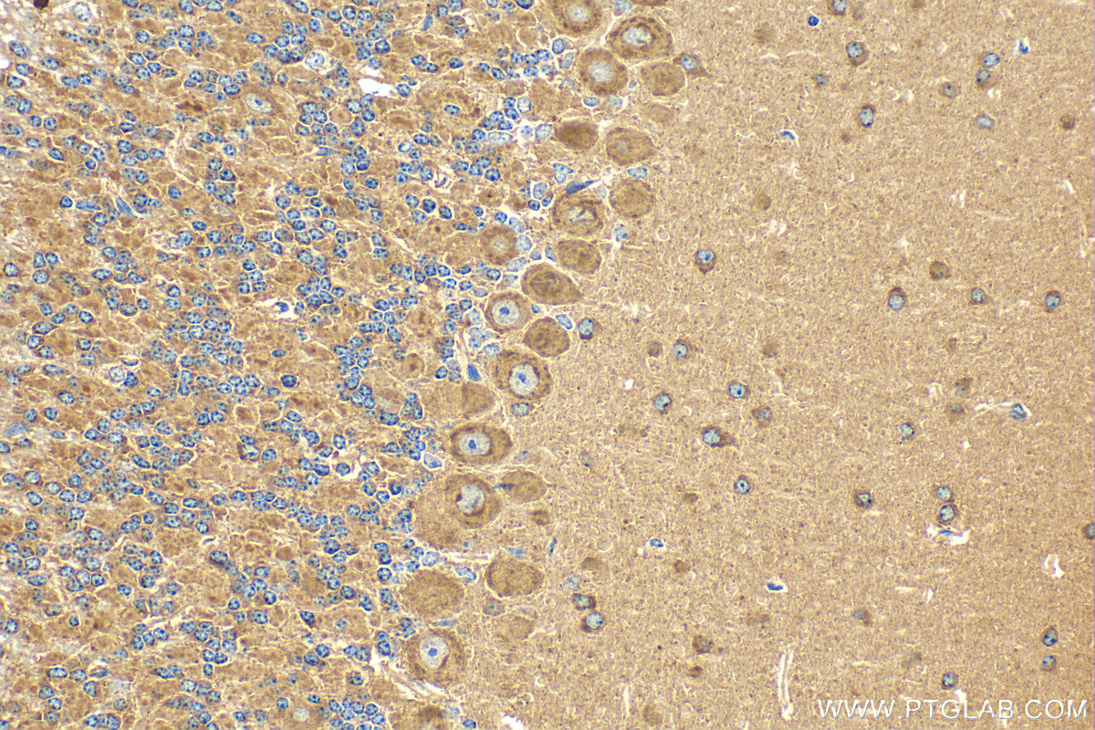 IHC staining of mouse cerebellum using 31635-1-AP