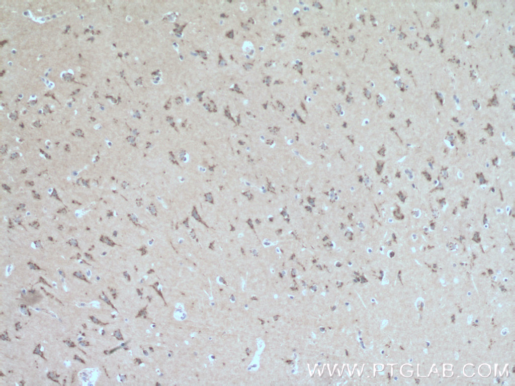 IHC staining of human brain using 23943-1-AP