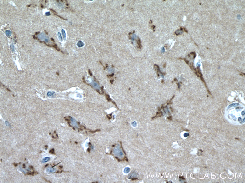 IHC staining of human brain using 23943-1-AP