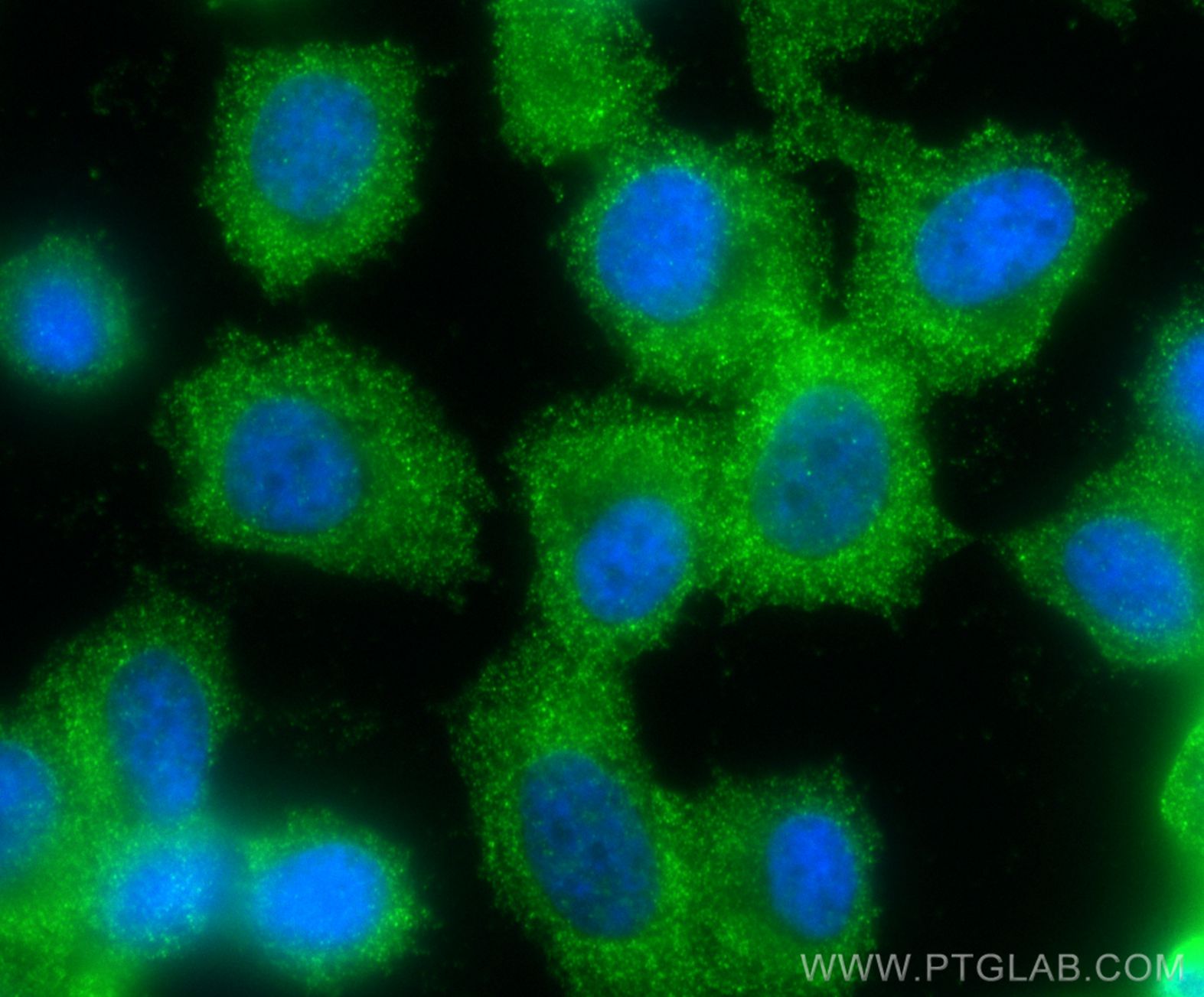IF Staining of PC-3 using 11503-1-AP