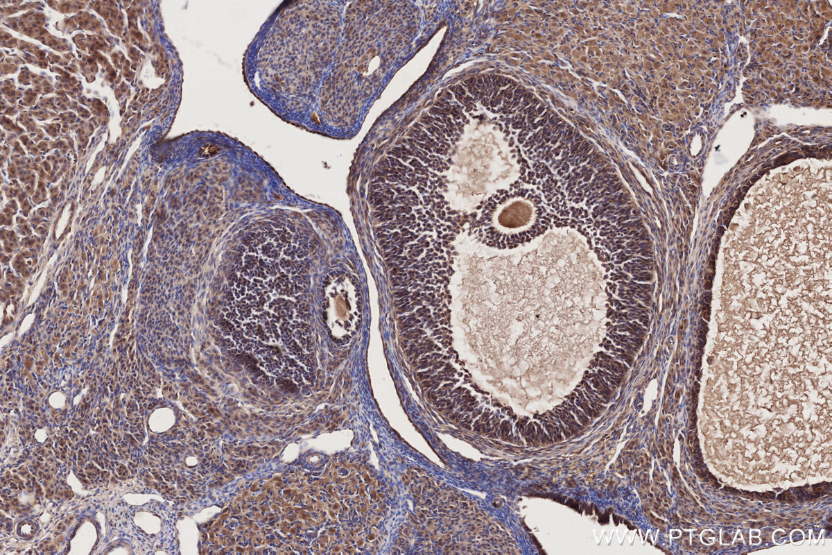 IHC staining of rat ovary using 11503-1-AP