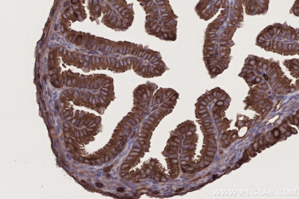 IHC staining of mouse ovary using 11503-1-AP