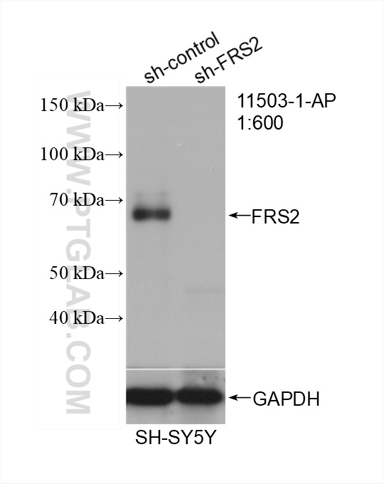 WB analysis of SH-SY5Y using 11503-1-AP