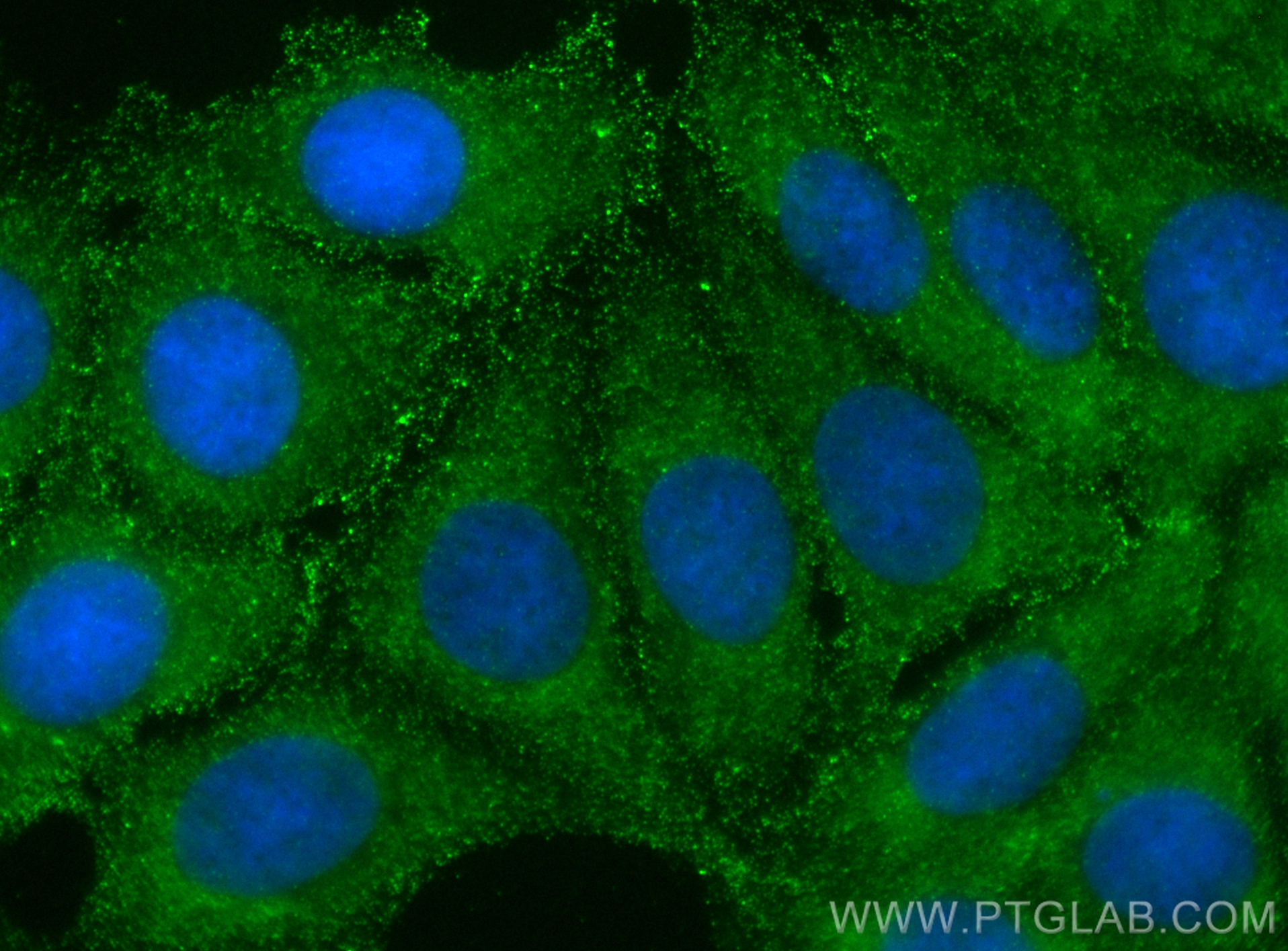 IF Staining of MCF-7 using 66263-1-Ig