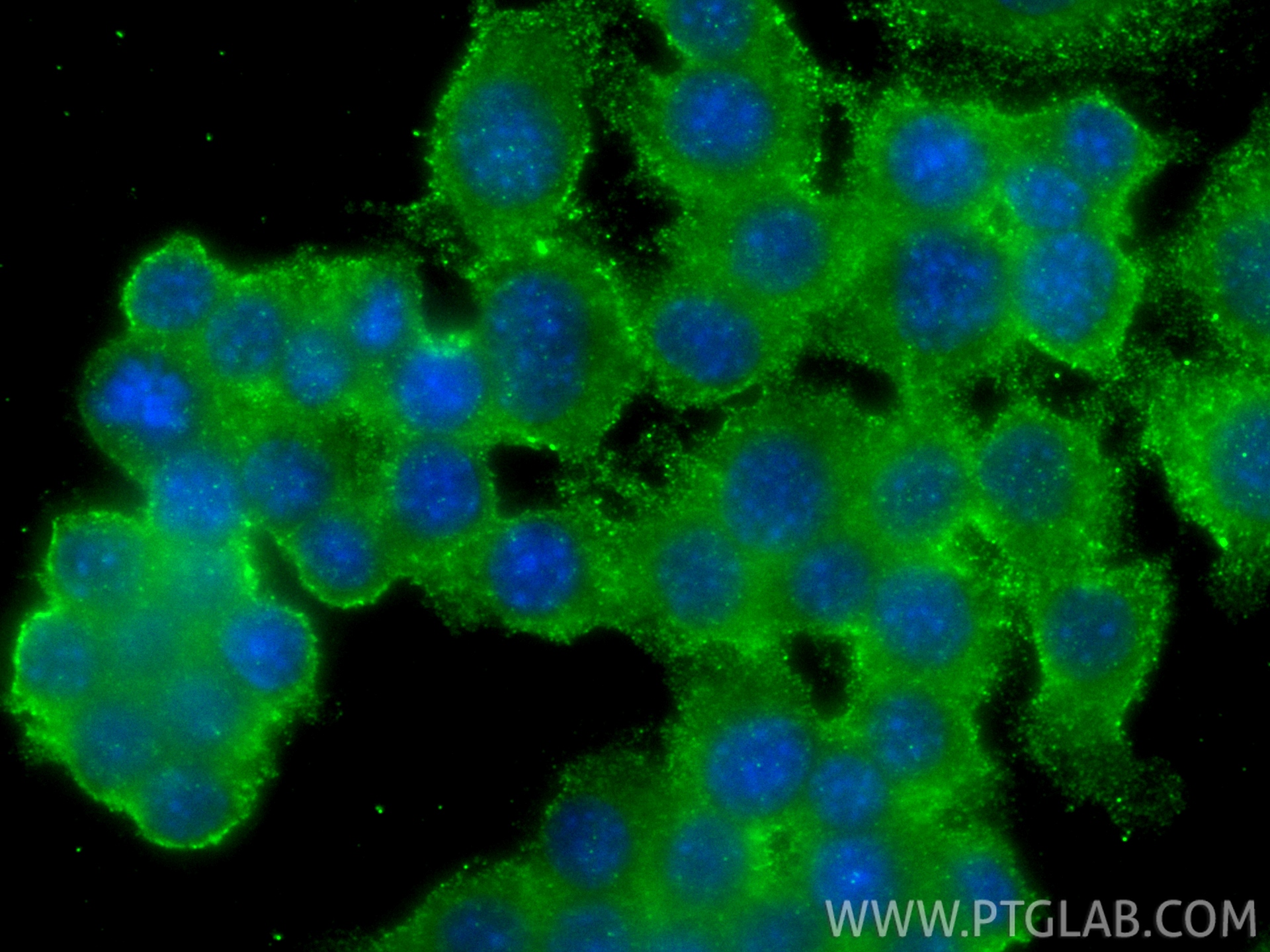 Immunofluorescent analysis of (4% PFA) fixed RAW 264.7 cells using FRS2 antibody (66263-1-Ig, Clone: 4E10H12 ) at dilution of 1:800 and CoraLite®488-Conjugated Goat Anti-Mouse IgG(H+L) (<a class='green' href='/productredirect?CatalogNo=SA00013-1' target='_blank'>SA00013-1</a>). IF Staining of RAW 264.7 using 66263-1-Ig