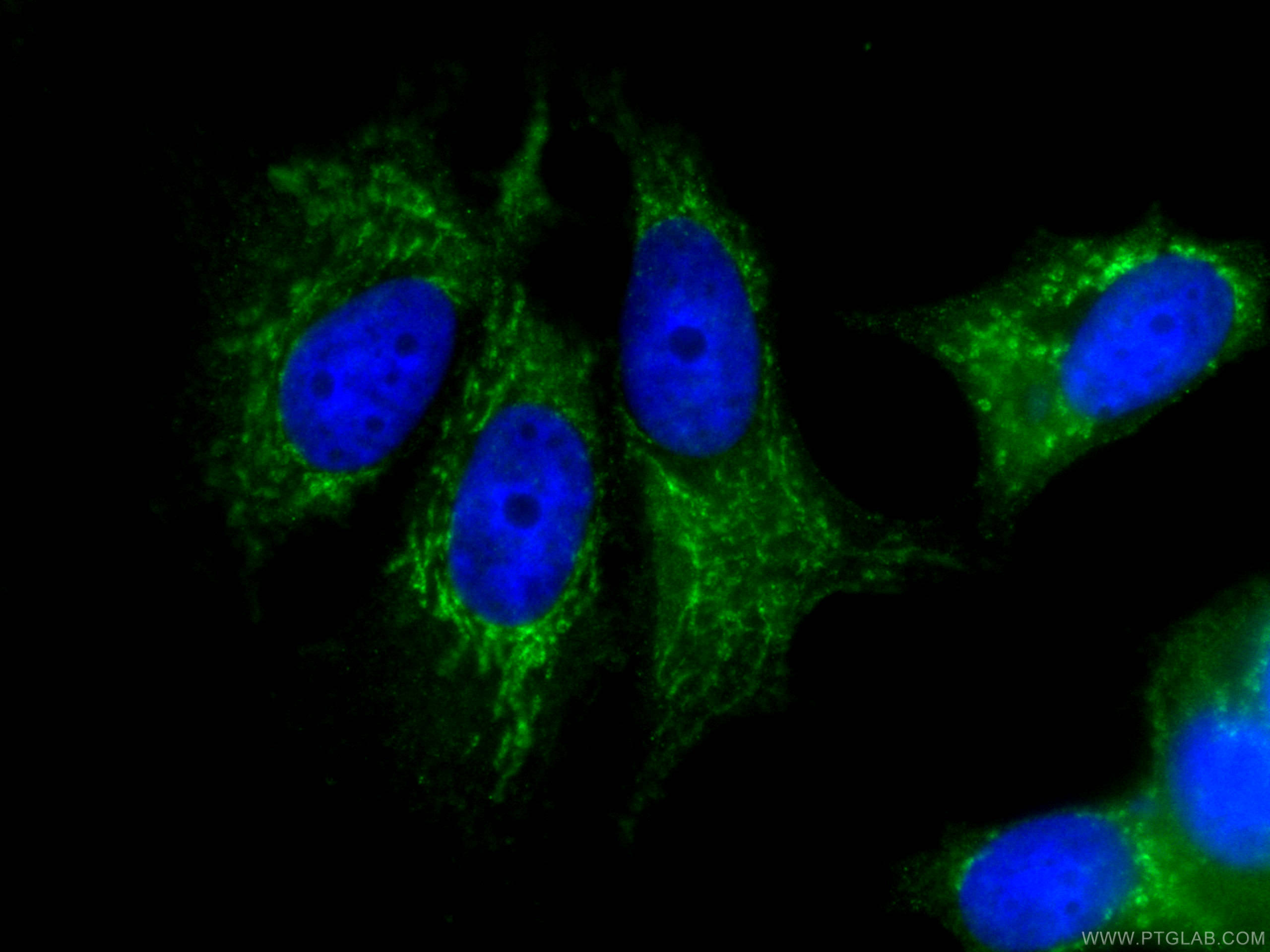 IF Staining of MCF-7 using CL488-66263