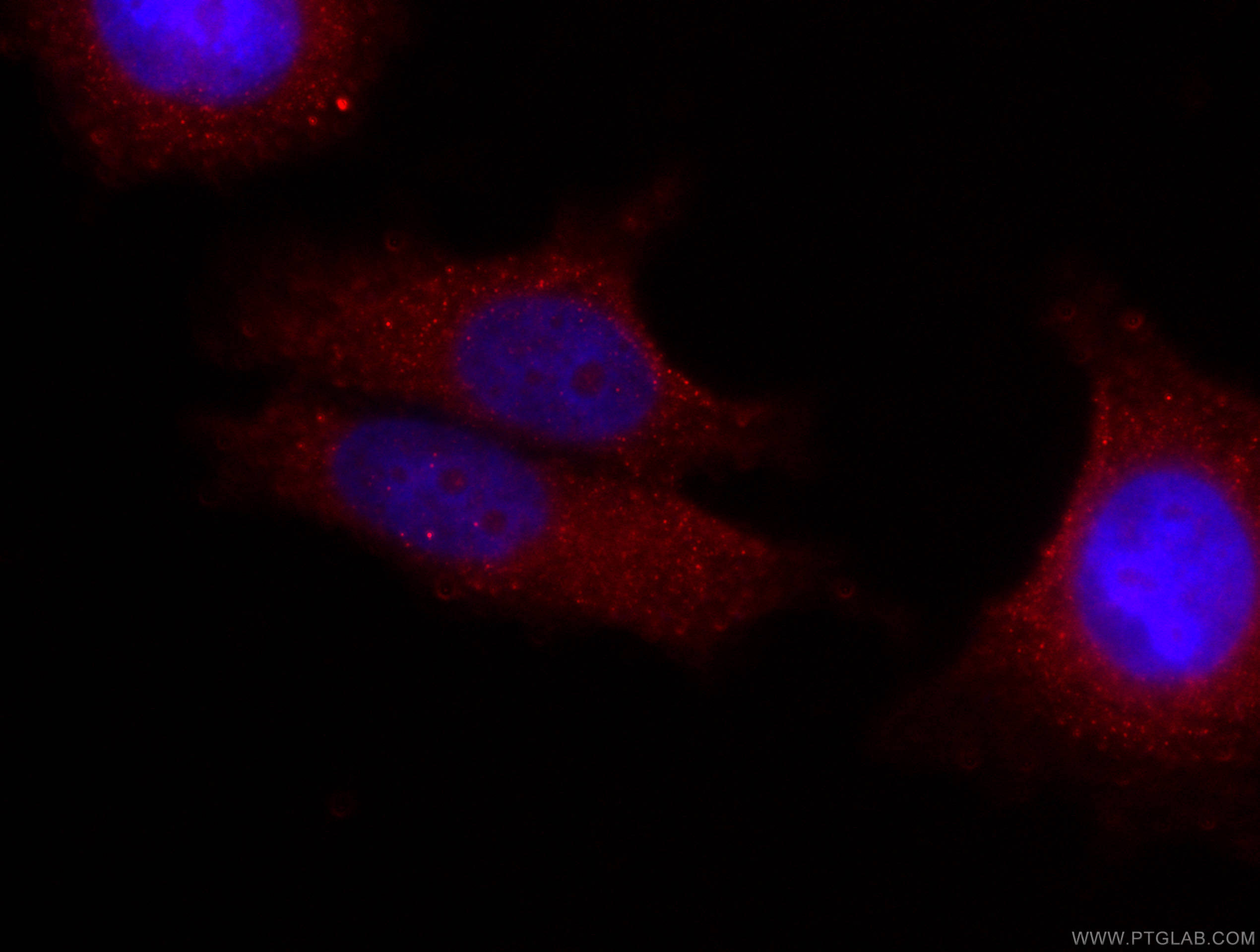 IF Staining of MCF-7 using CL594-66263