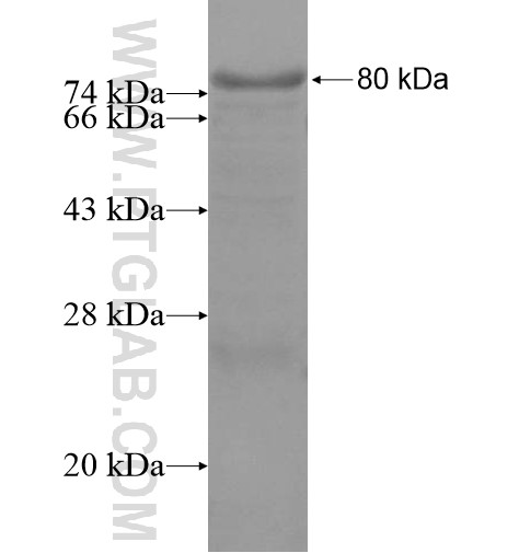 FSCB fusion protein Ag15340 SDS-PAGE FSCB fusion protein Ag15340 SDS-PAGE