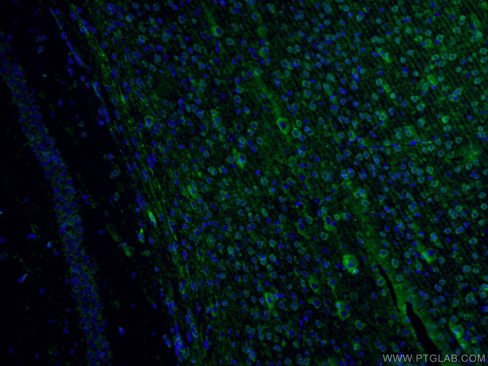 IF Staining of mouse brain using 14384-1-AP