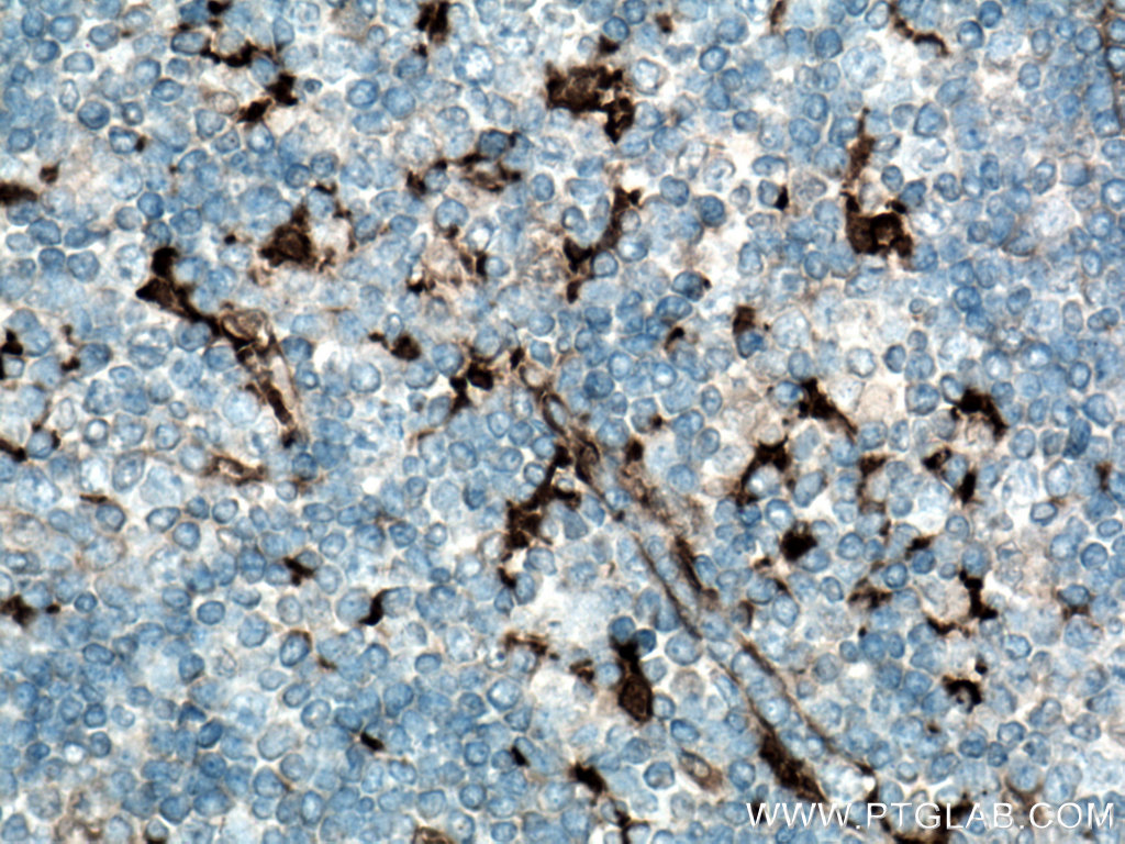 IHC staining of human tonsillitis using 14384-1-AP