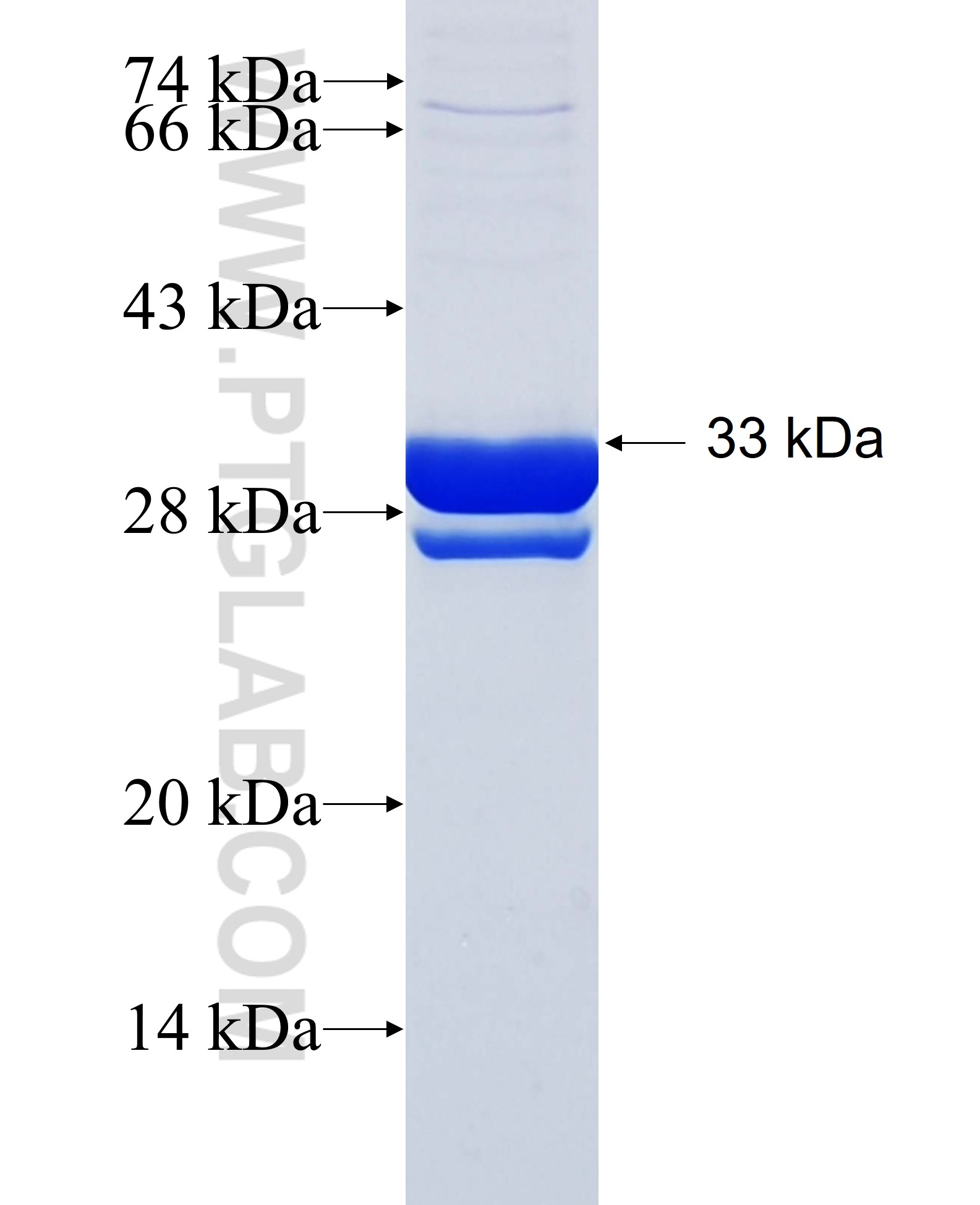 FSD1 fusion protein Ag26566 SDS-PAGE FSD1 fusion protein Ag26566 SDS-PAGE