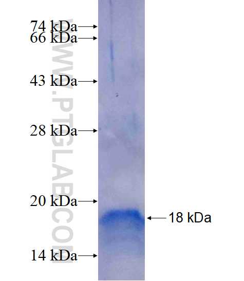 FSD1L fusion protein Ag15499 SDS-PAGE FSD1L fusion protein Ag15499 SDS-PAGE