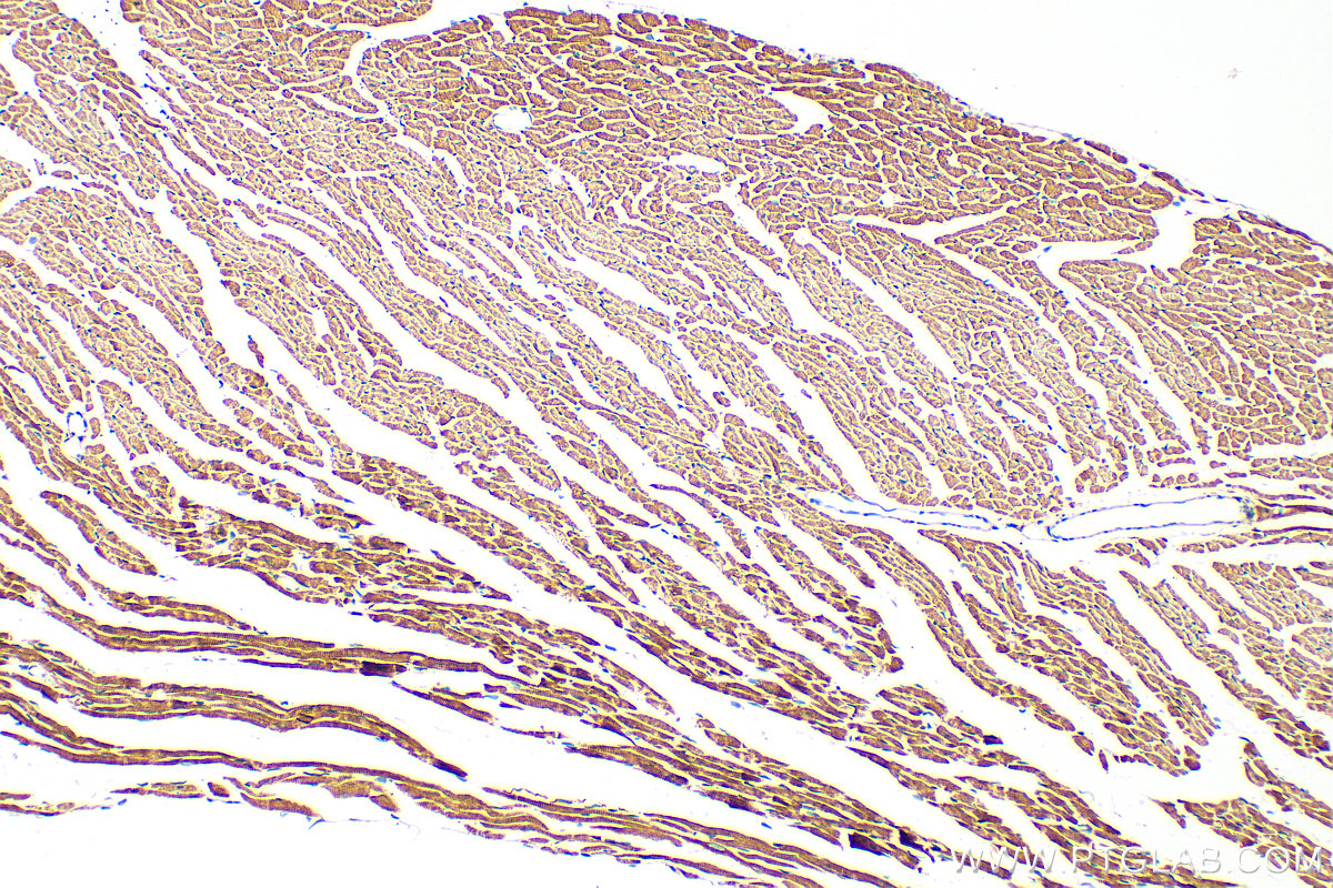 IHC staining of mouse heart using 25609-1-AP