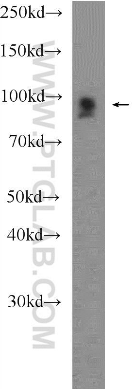 WB analysis of mouse heart using 25609-1-AP