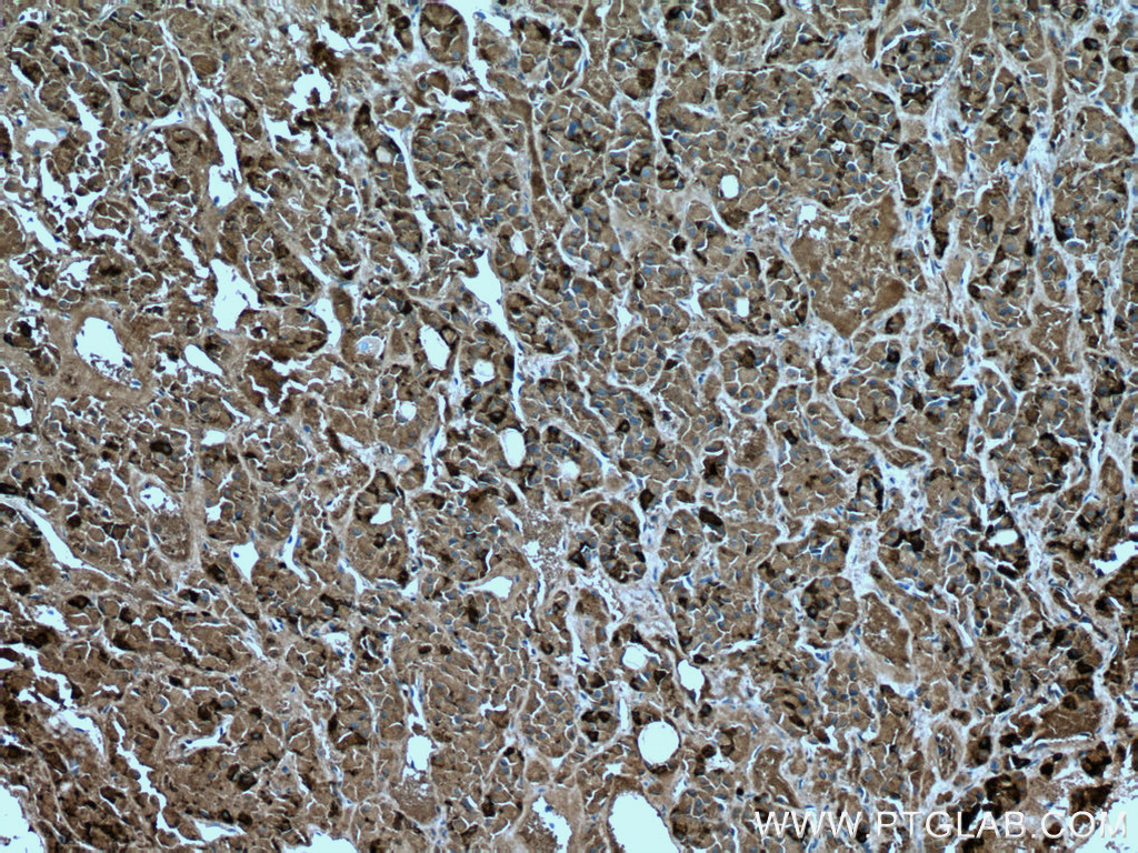 IHC staining of human pituitary using 67131-1-Ig