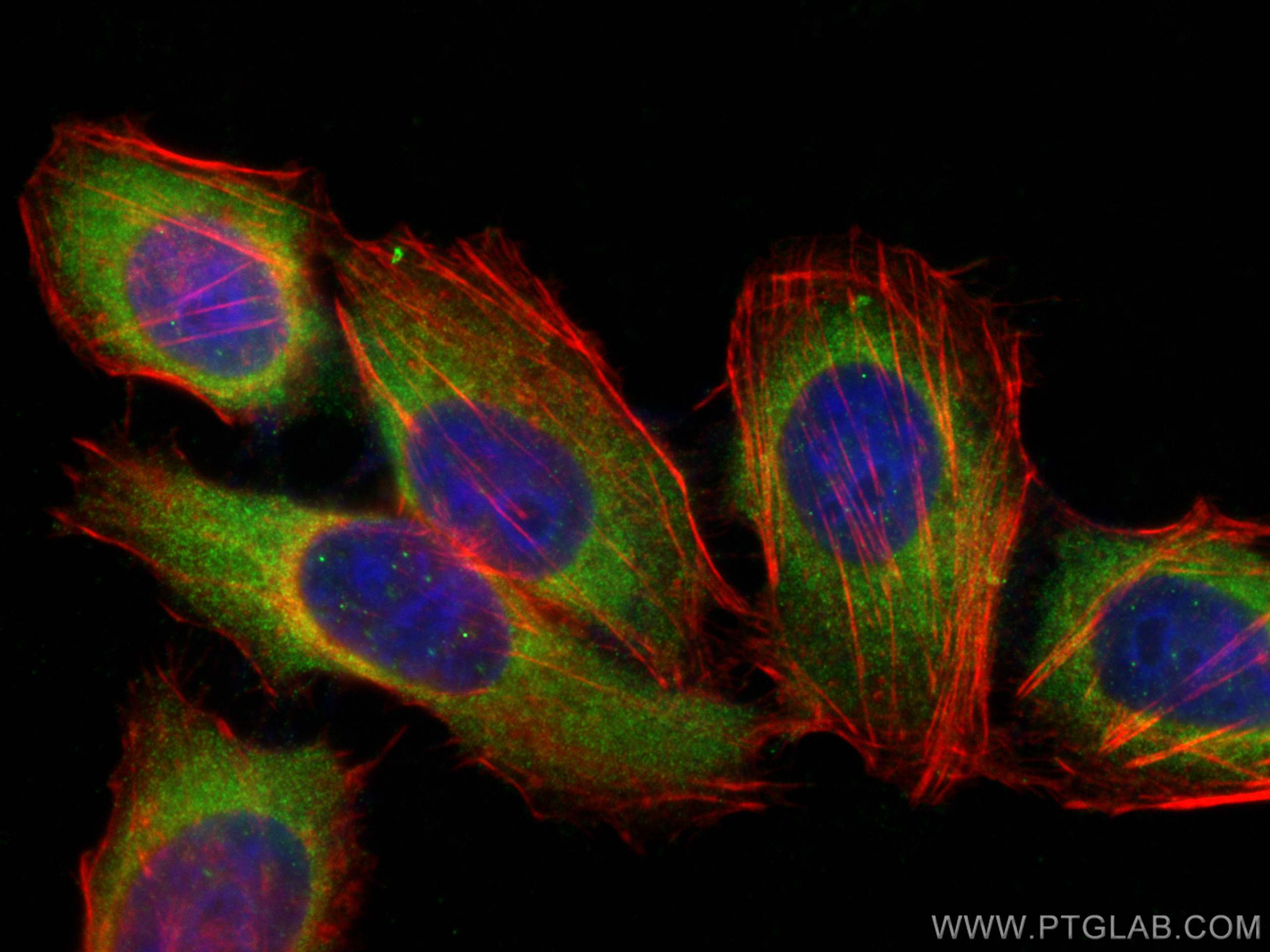 IF Staining of HepG2 using 22665-1-AP