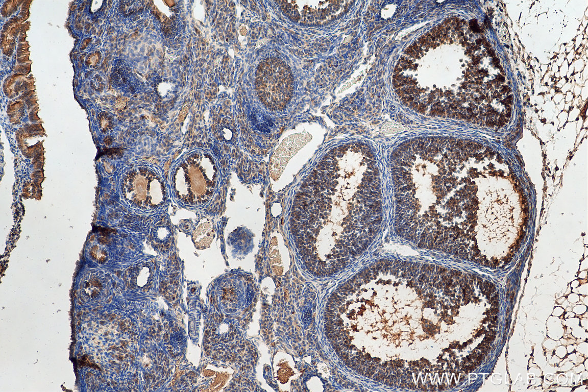 IHC staining of mouse ovary using 22665-1-AP