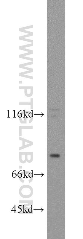 FSHR Polyclonal antibody