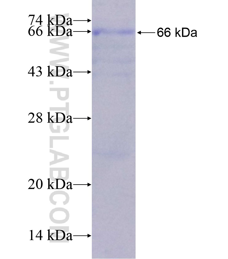 FSHR fusion protein Ag18409 SDS-PAGE FSHR fusion protein Ag18409 SDS-PAGE