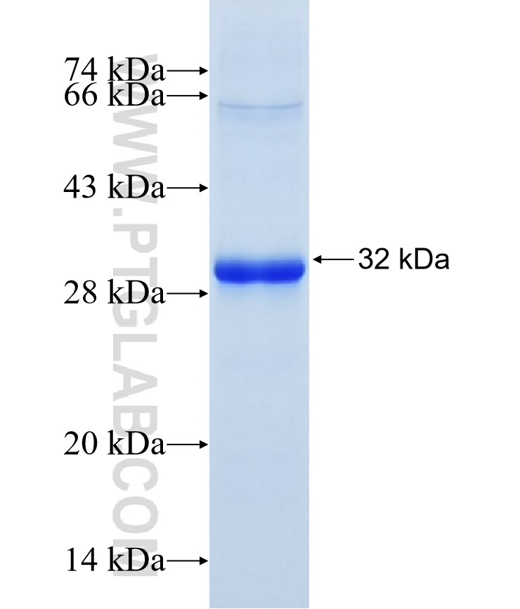 FST fusion protein Ag26415 SDS-PAGE FST fusion protein Ag26415 SDS-PAGE