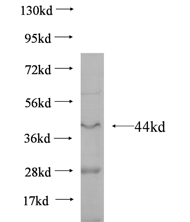FST fusion protein Ag6447 SDS-PAGE FST fusion protein Ag6447 SDS-PAGE