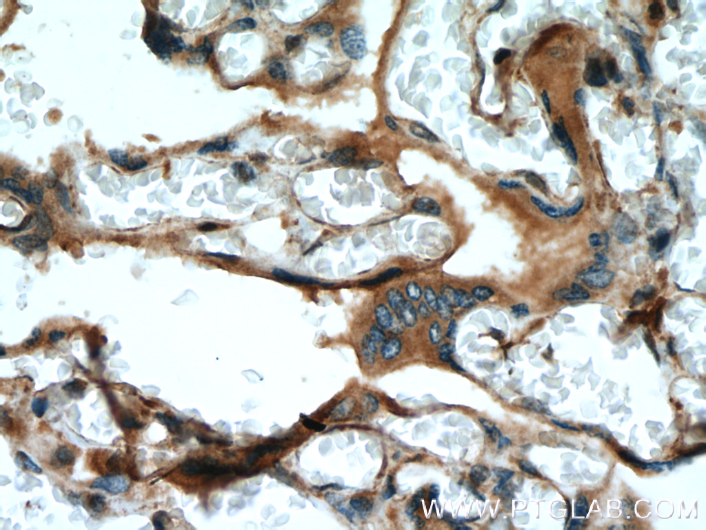 IHC staining of human placenta using 20182-1-AP