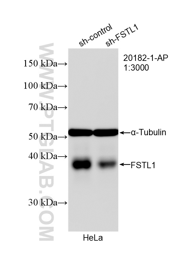 WB analysis of HeLa using 20182-1-AP WB analysis of HeLa using 20182-1-AP