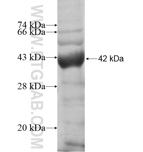 FSTL4 fusion protein Ag11550 SDS-PAGE FSTL4 fusion protein Ag11550 SDS-PAGE