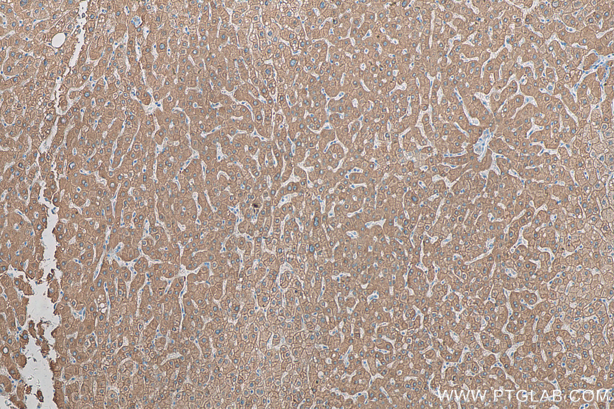 IHC staining of human liver using 21959-1-AP