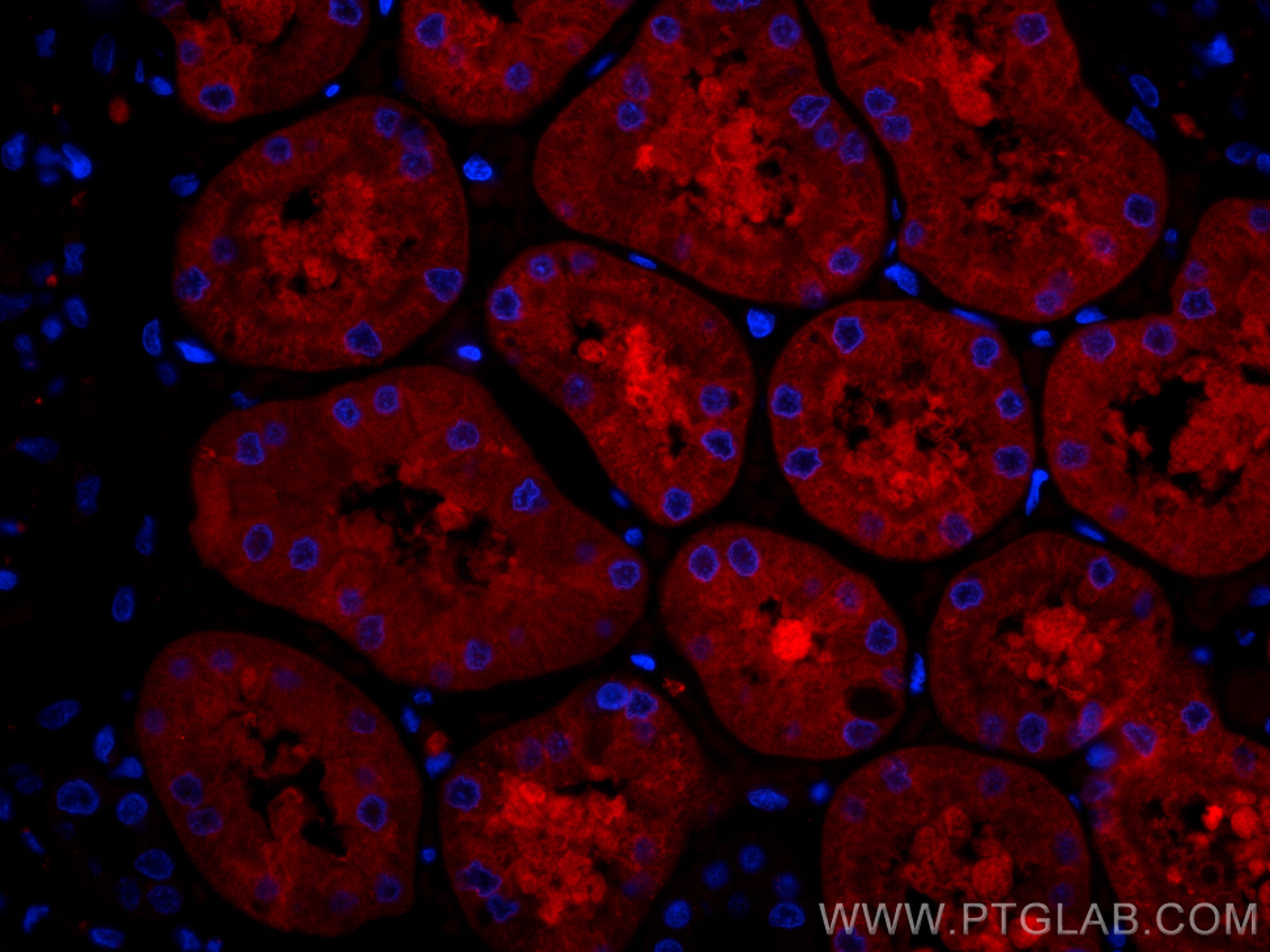 IF Staining of human kidney using CL594-66979