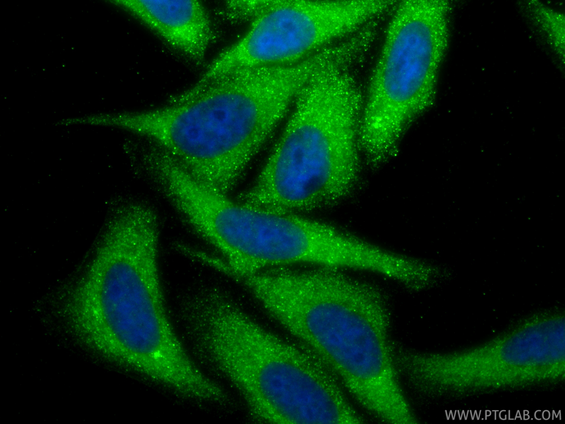 IF Staining of HepG2 using 11682-1-AP IF Staining of HepG2 using 11682-1-AP