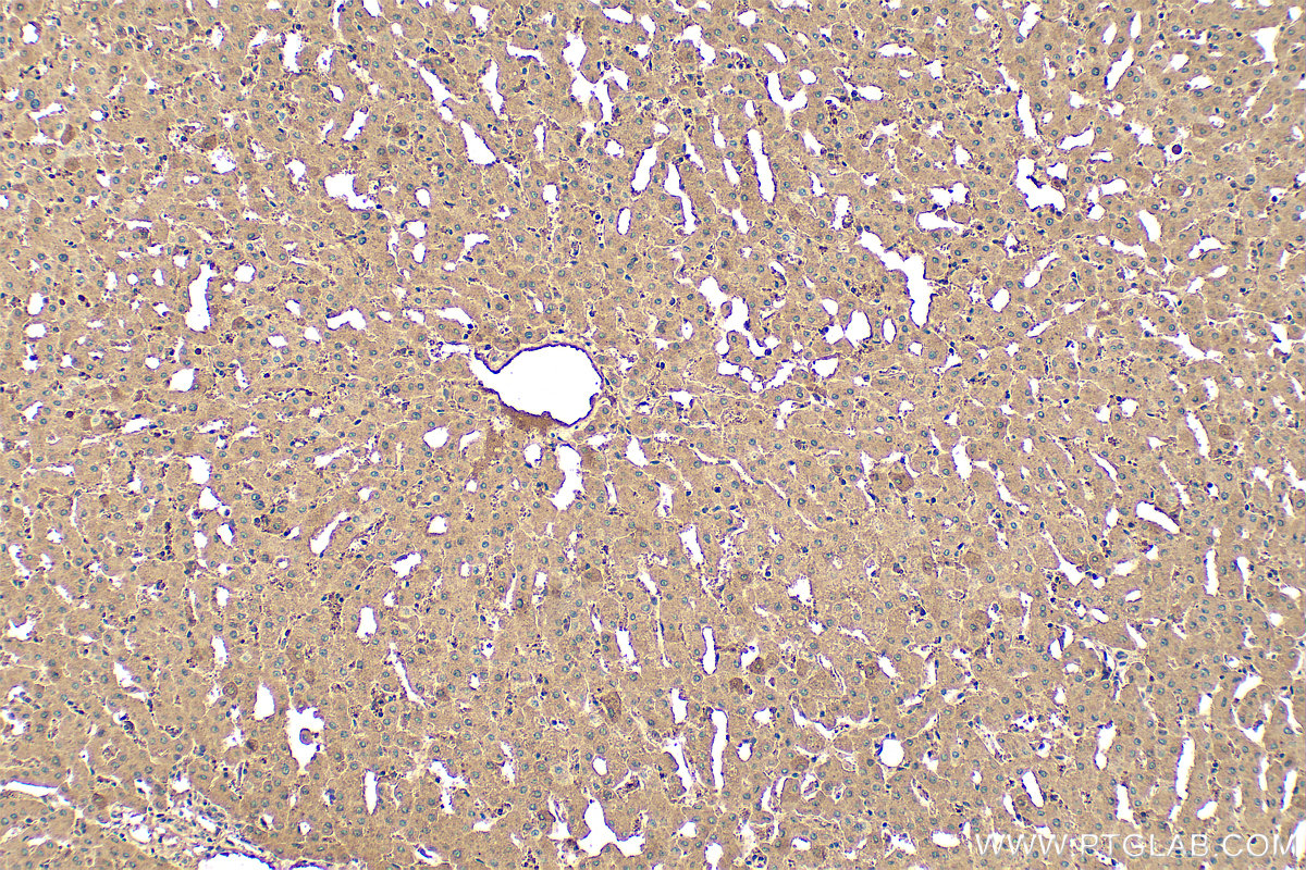 IHC staining of human liver using 11682-1-AP