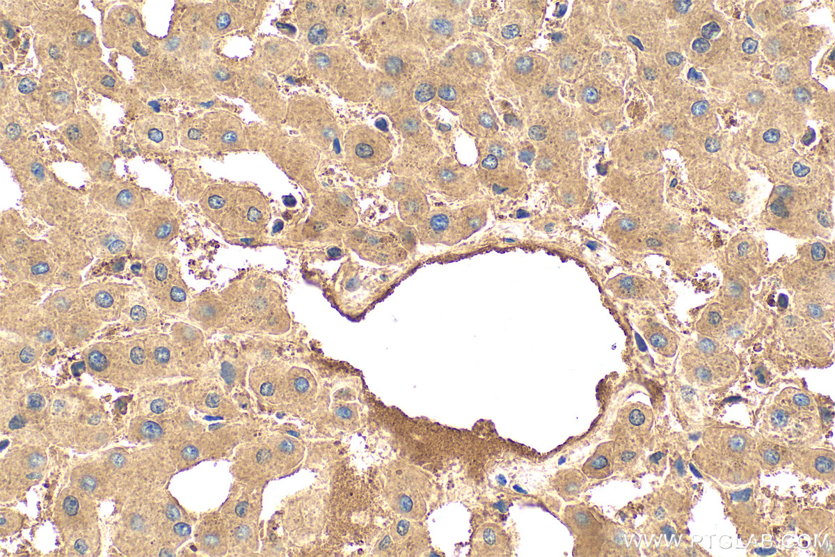 IHC staining of human liver using 11682-1-AP