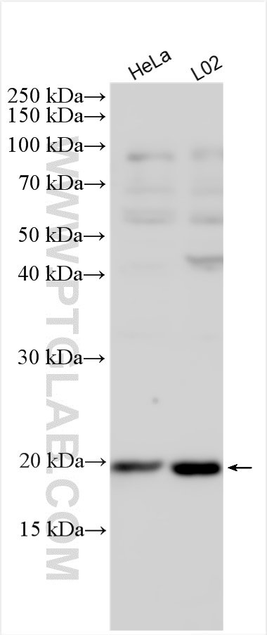 Ferritin heavy chain