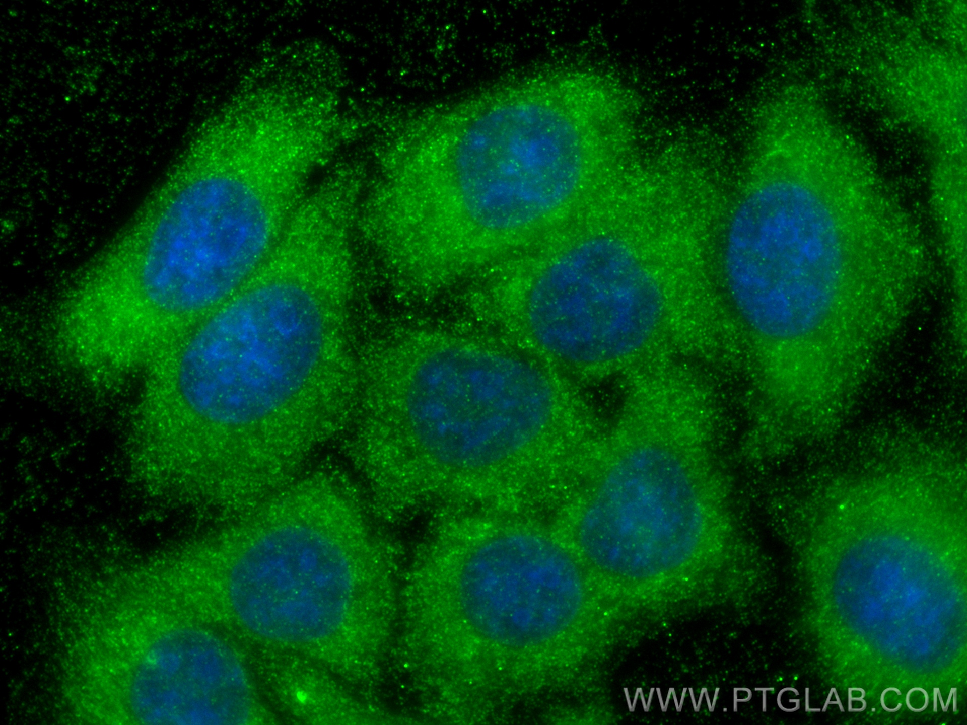 IF Staining of HepG2 using 60875-5-Ig (same clone as 60875-5-PBS)