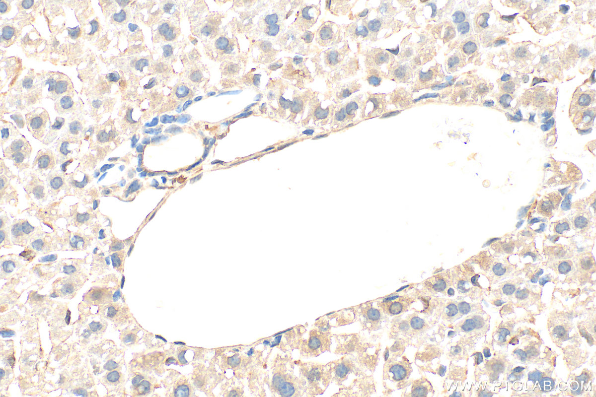 Immunohistochemical analysis of paraffin-embedded mouse liver tissue slide using 60875-5-Ig (Ferritin heavy chain antibody) at dilution of 1:500 (under 40x lens). Heat mediated antigen retrieval with Tris-EDTA buffer (pH 9.0). IHC staining of mouse liver using 60875-5-Ig