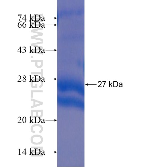 FTH1 fusion protein Ag21386 SDS-PAGE