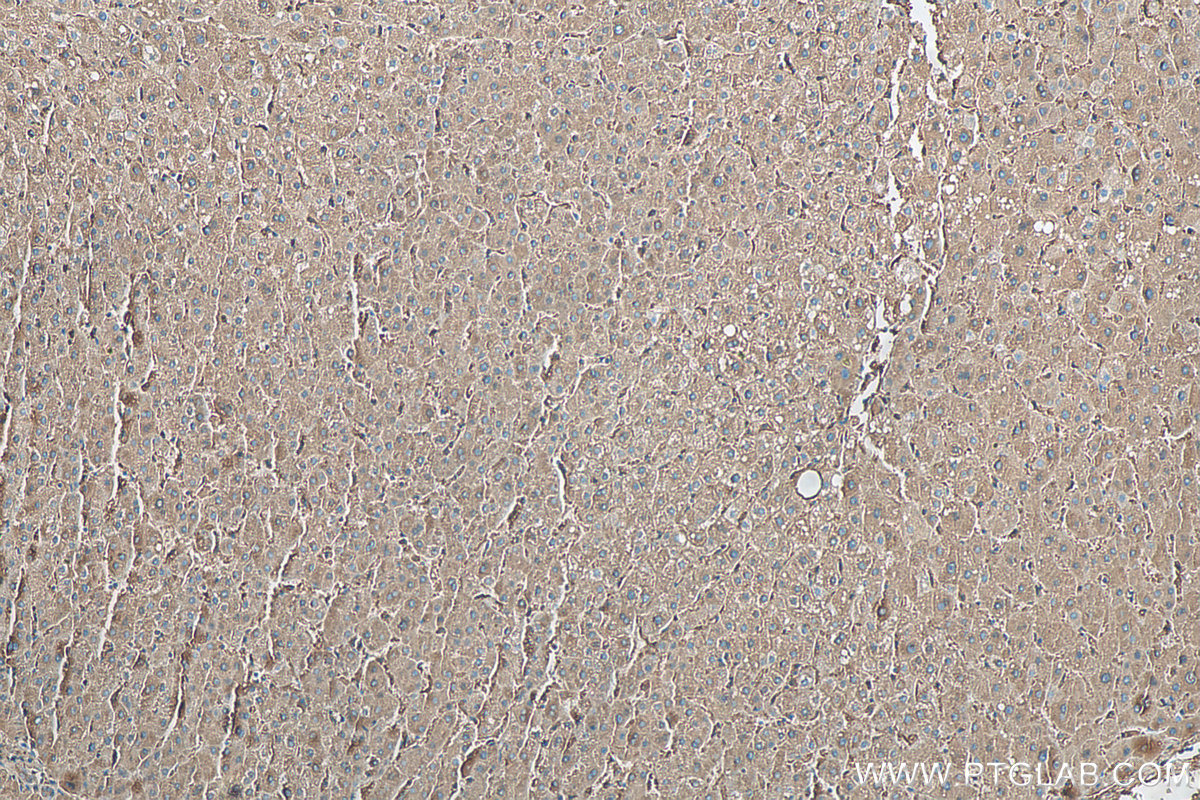 IHC staining of human liver using 10727-1-AP