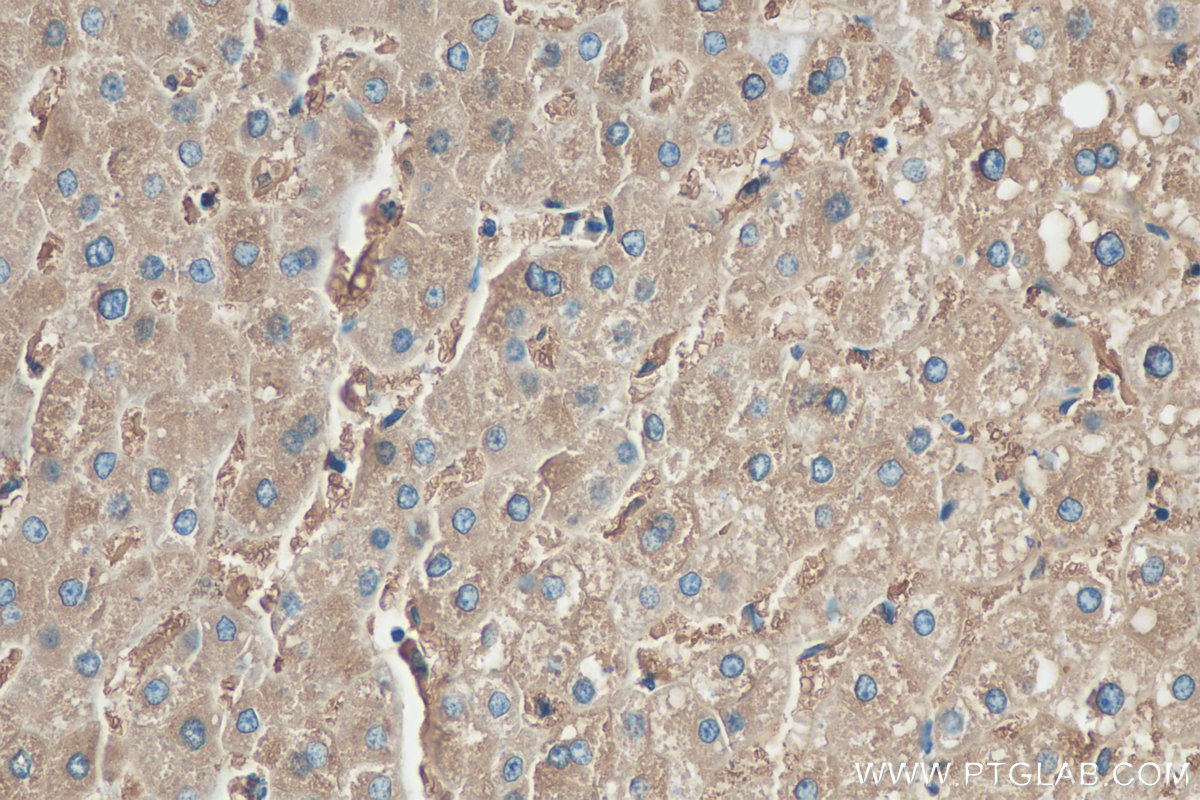 IHC staining of human liver using 10727-1-AP