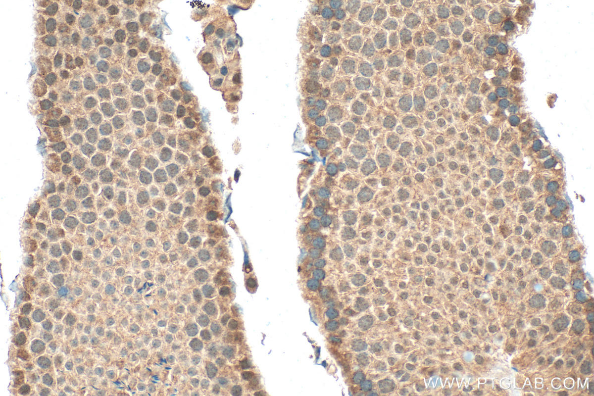 IHC staining of mouse testis using 27226-1-AP