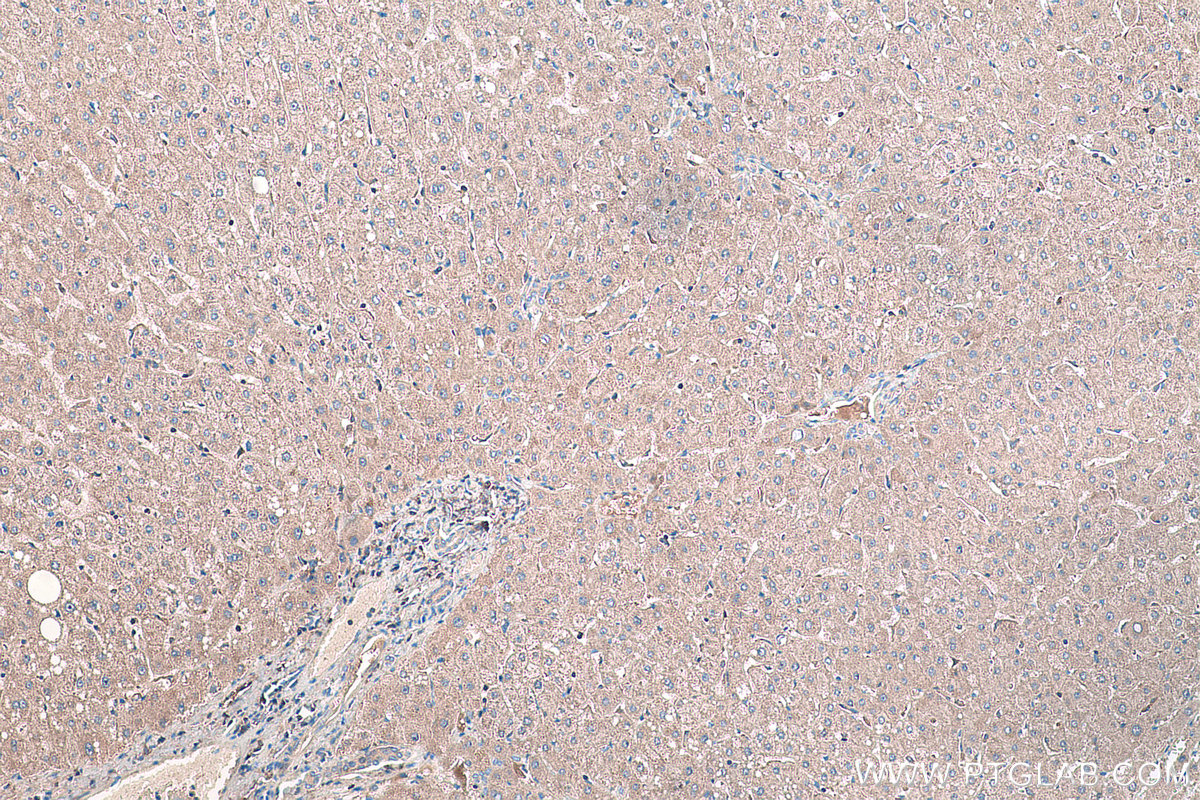 IHC staining of human liver using 11620-1-AP