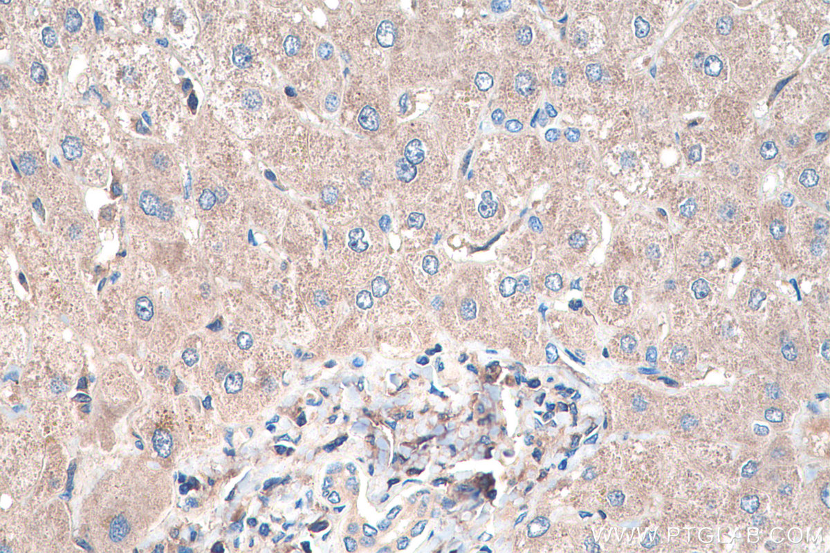 IHC staining of human liver using 11620-1-AP