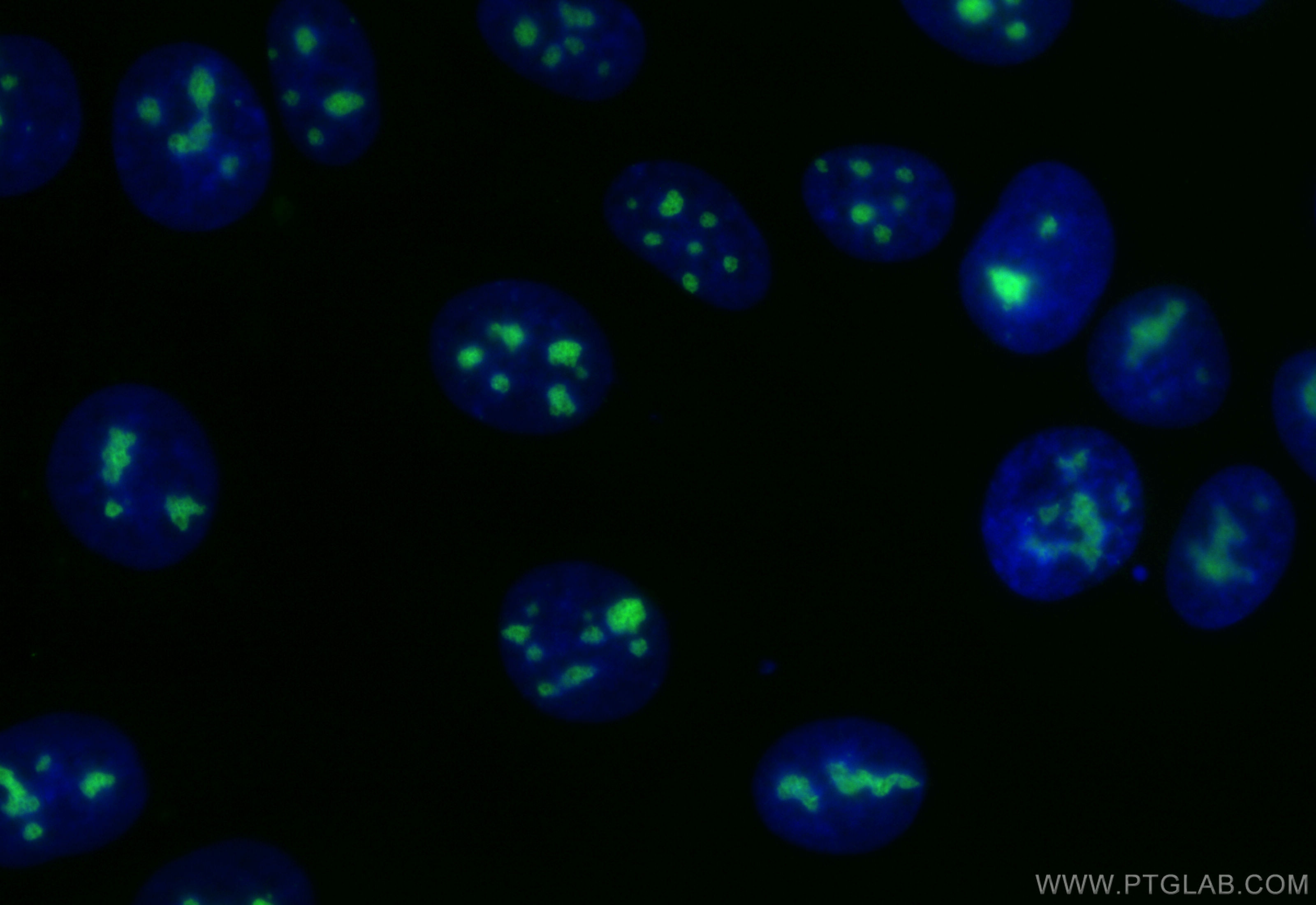 IF Staining of MCF-7 using CL488-84311-6